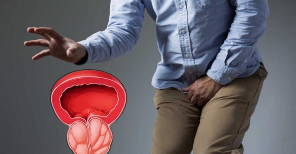 síntomas de prostatitis en hombres